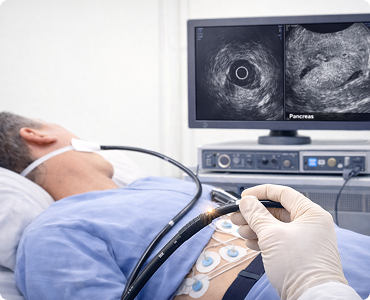 Endoscopic Ultrasound (EUS)