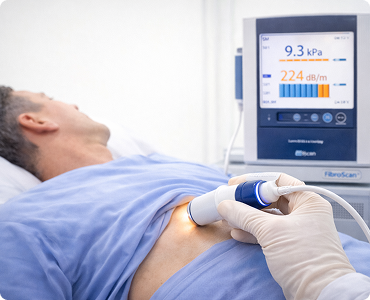 FibroScan